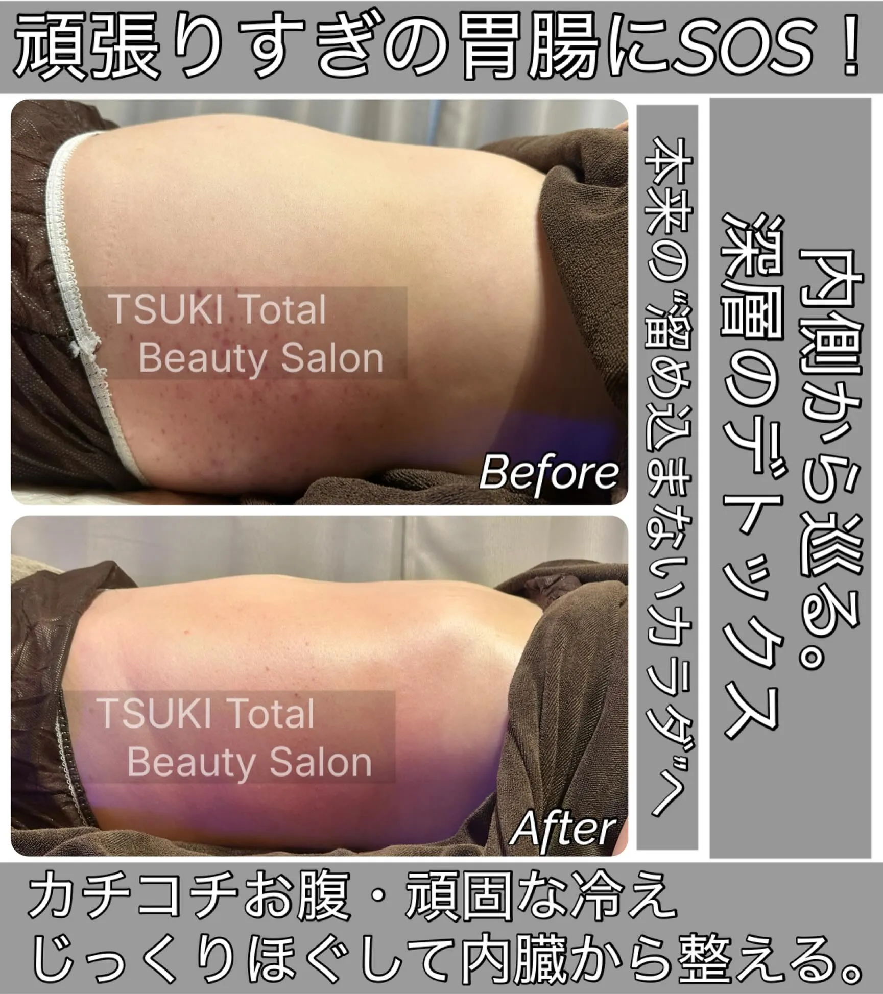 【自分のお腹、これが「普通」だと思っていませんか？】