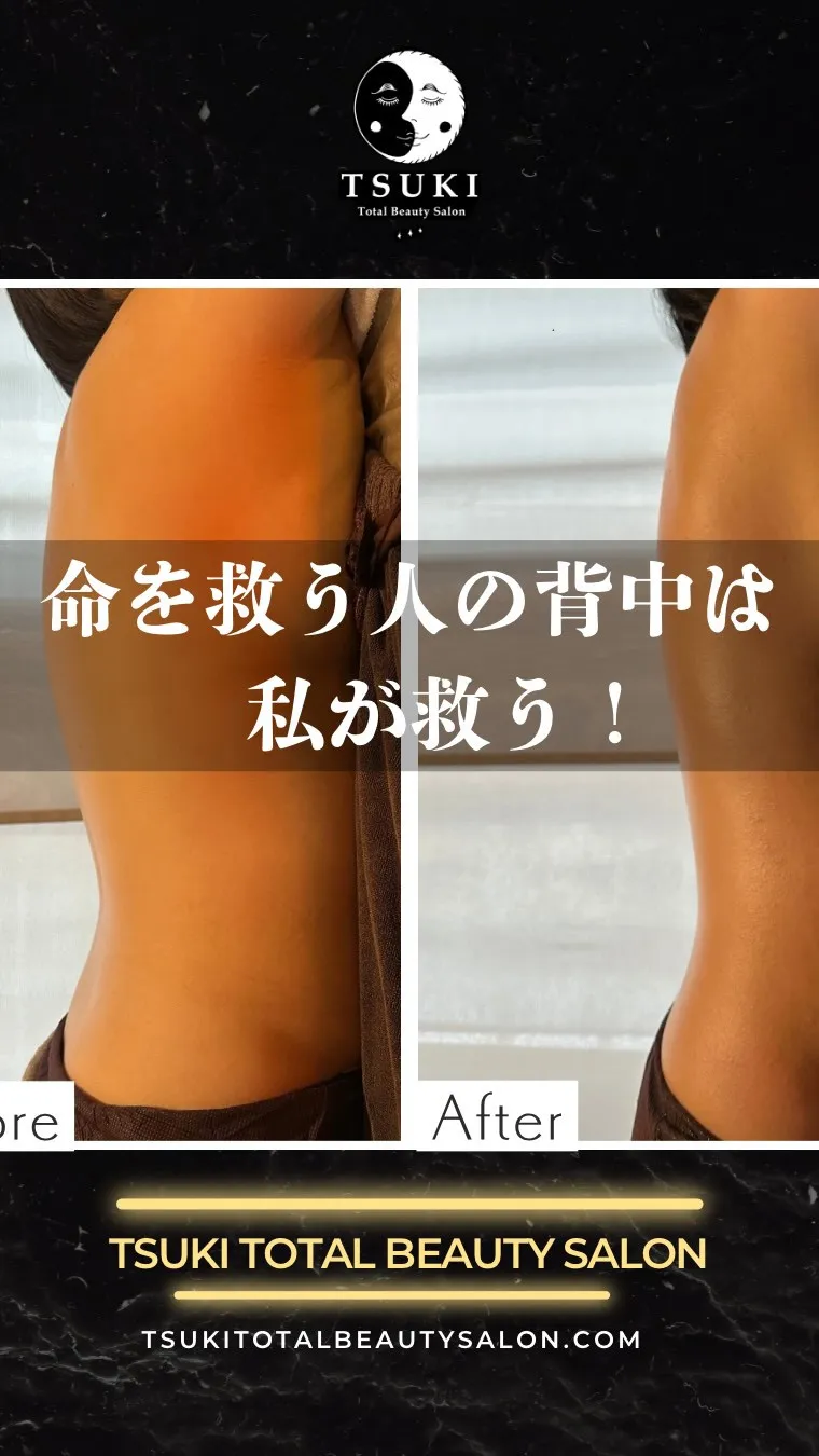 命を救う人の背中は、私が救う。